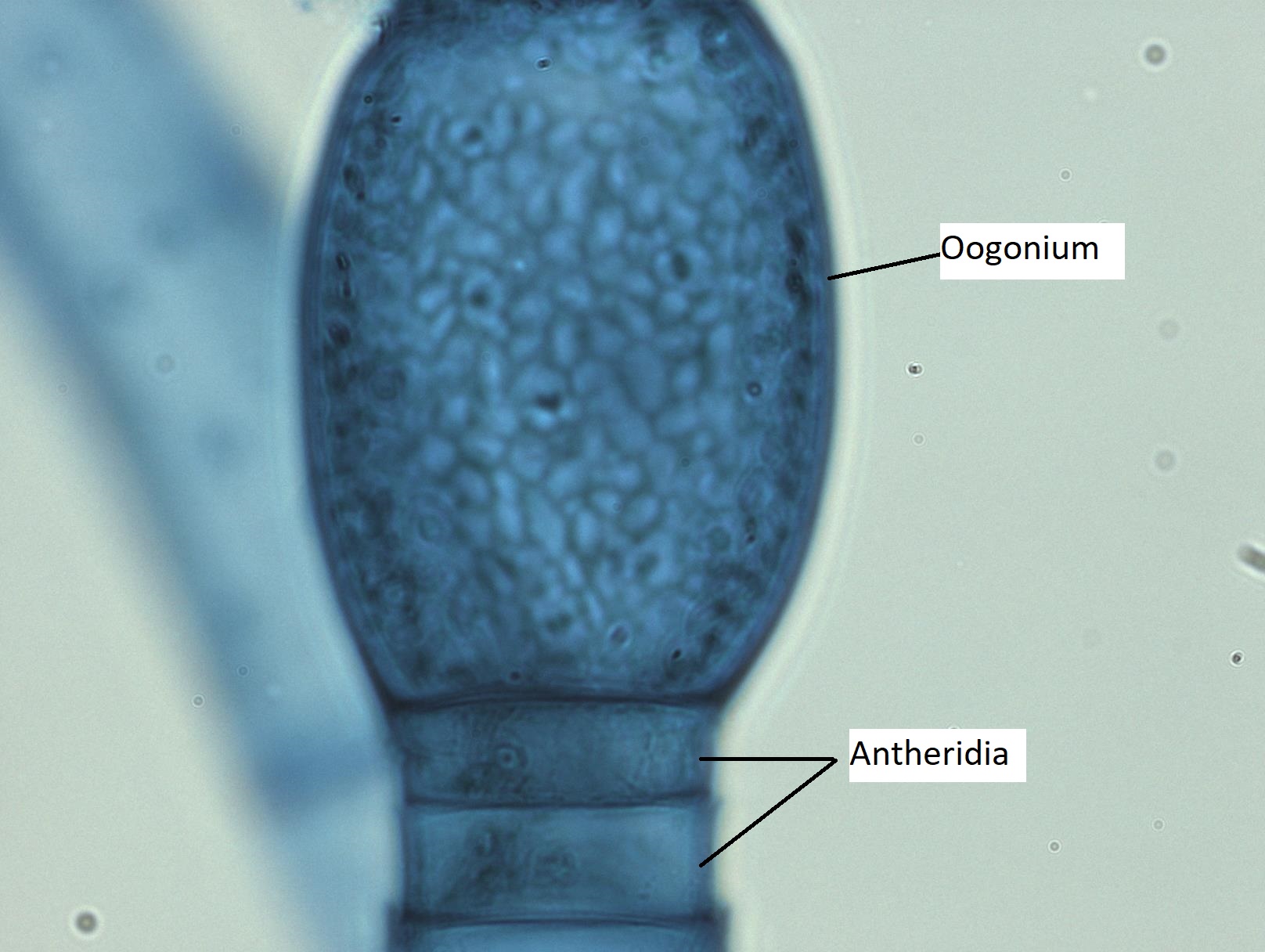 Un edegonio macrandroso, que muestra un oogonio grande y un anteridios más pequeños apilados debajo de él