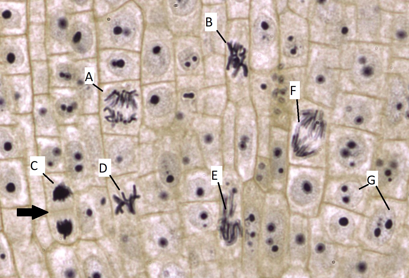 Cells in many stages of mitosis. One, indicated by a black arrow, is in telophase.
