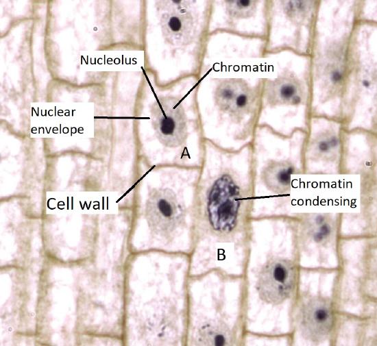 Many cells at different stages in the cell cycle