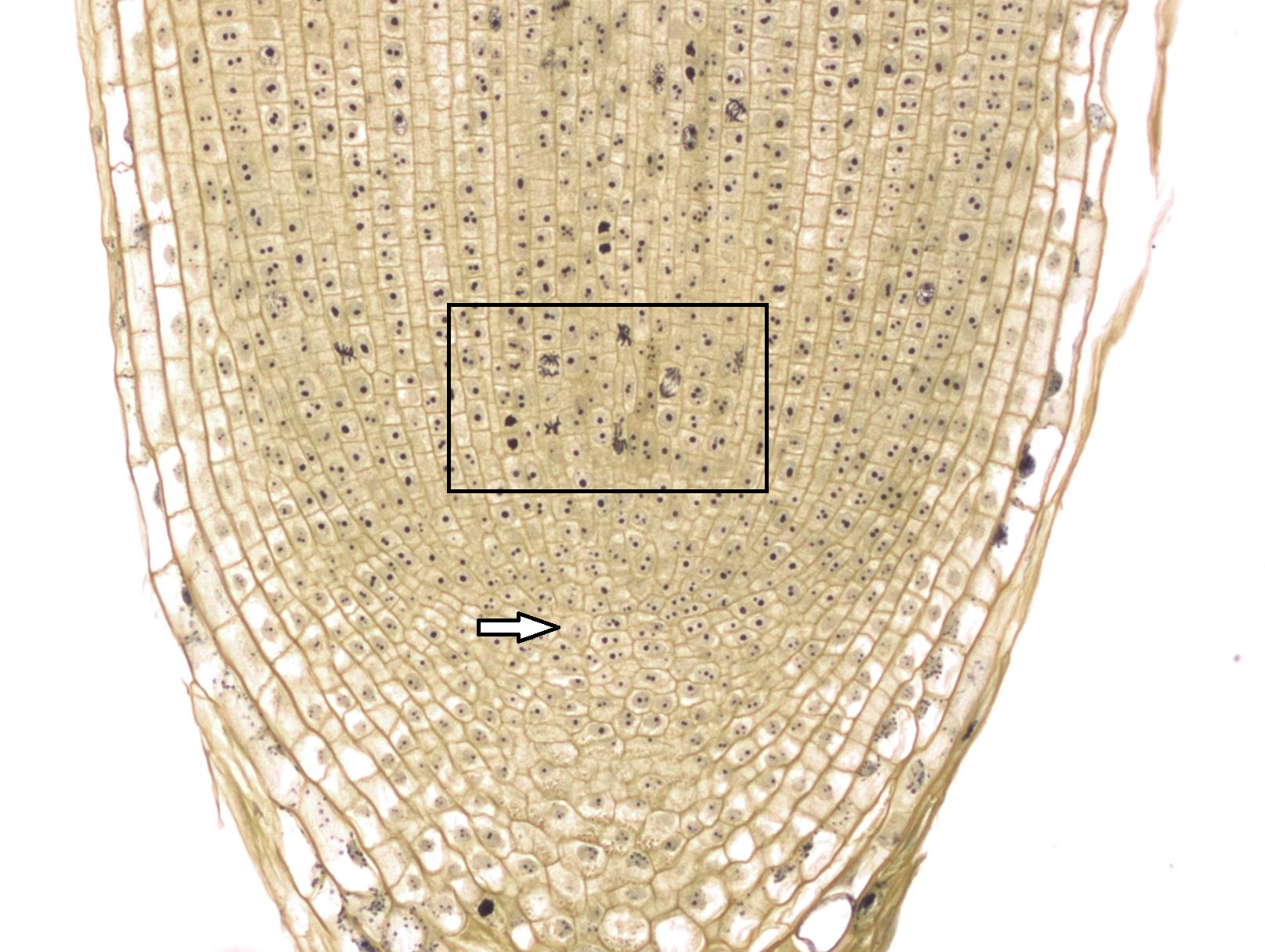 Punta de raíz de cebolla a mayor aumento, muchas células tienen cromosomas visibles debido a la tinción