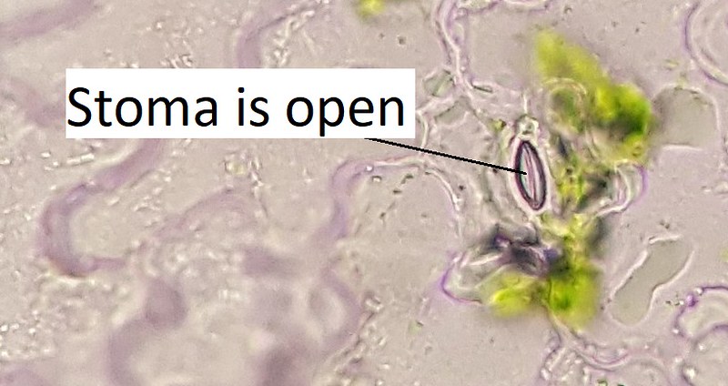An open stoma