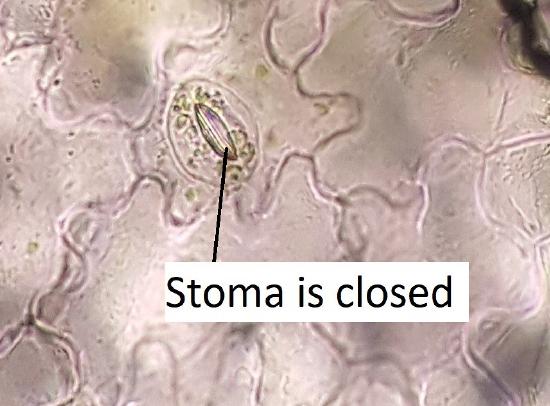 A closed stoma