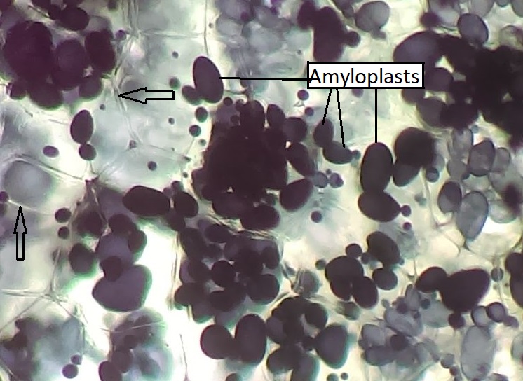 Amiloplastos en células de papa que han sido teñidas con yodo