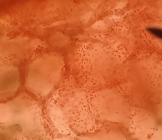 Cromoplastos dentro de las células epidérmicas del pimiento rojo