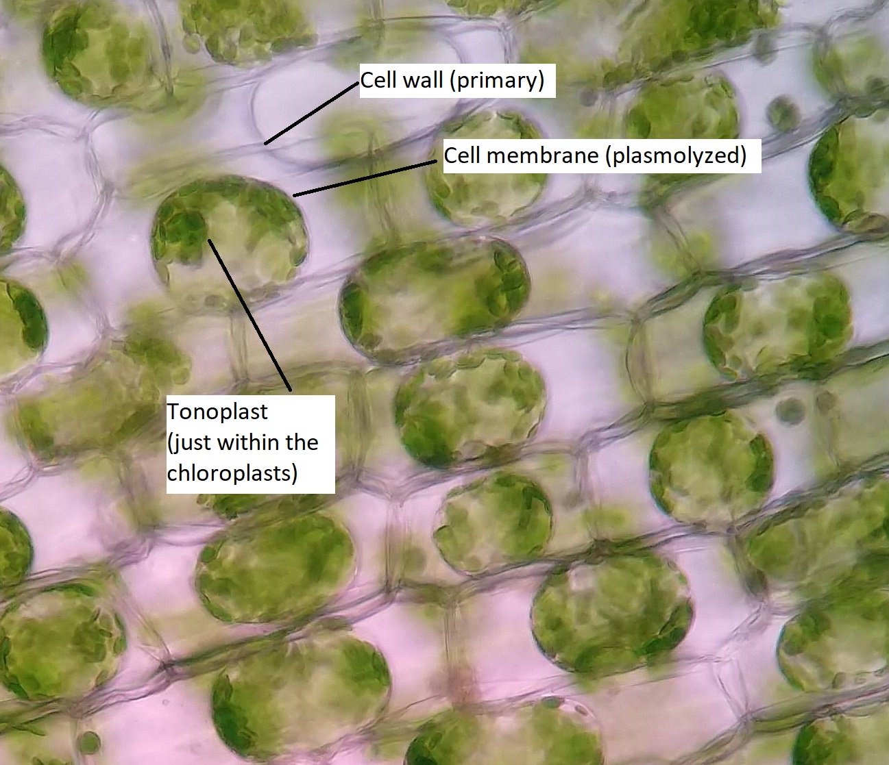 Plasmolysis of Elodea cells in salt water