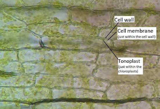 Elodea leaf cells 