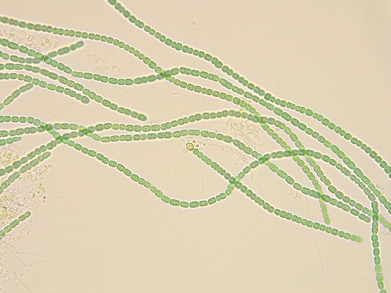 Cuerdas de células cianobacterianas desde dentro de las hojas de helecho acuático