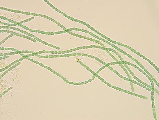 Strings of cyanobacterial cells from within the water fern leaves