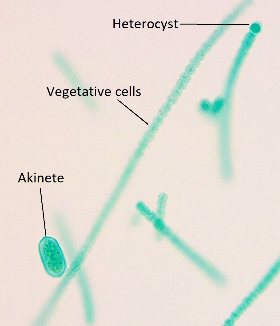 Una colonia de Anabaena que muestra los tres tipos de células