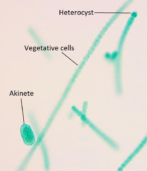 A colony of Anabaena showing all three cell types