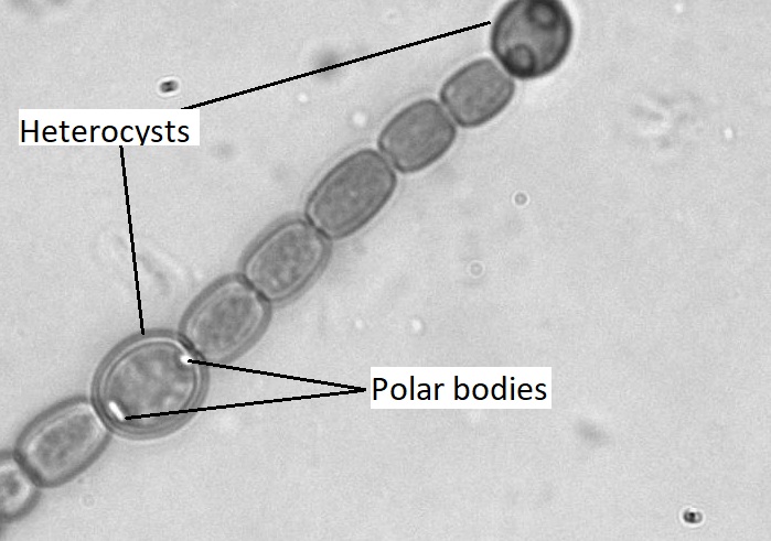 Una imagen en blanco y negro de Anabaena mostrando dos heterocistas y sus cuerpos polares