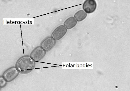 A black and white image of Anabaena showing two heterocysts and their polar bodies