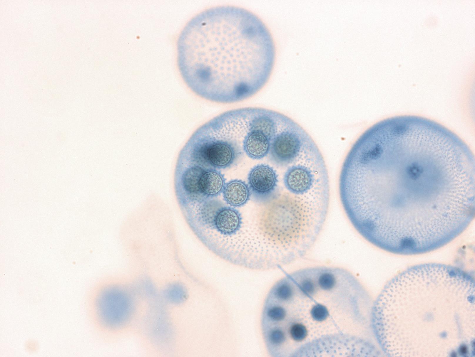 Varias colonias Volvox en un portaobjetos de microscopio