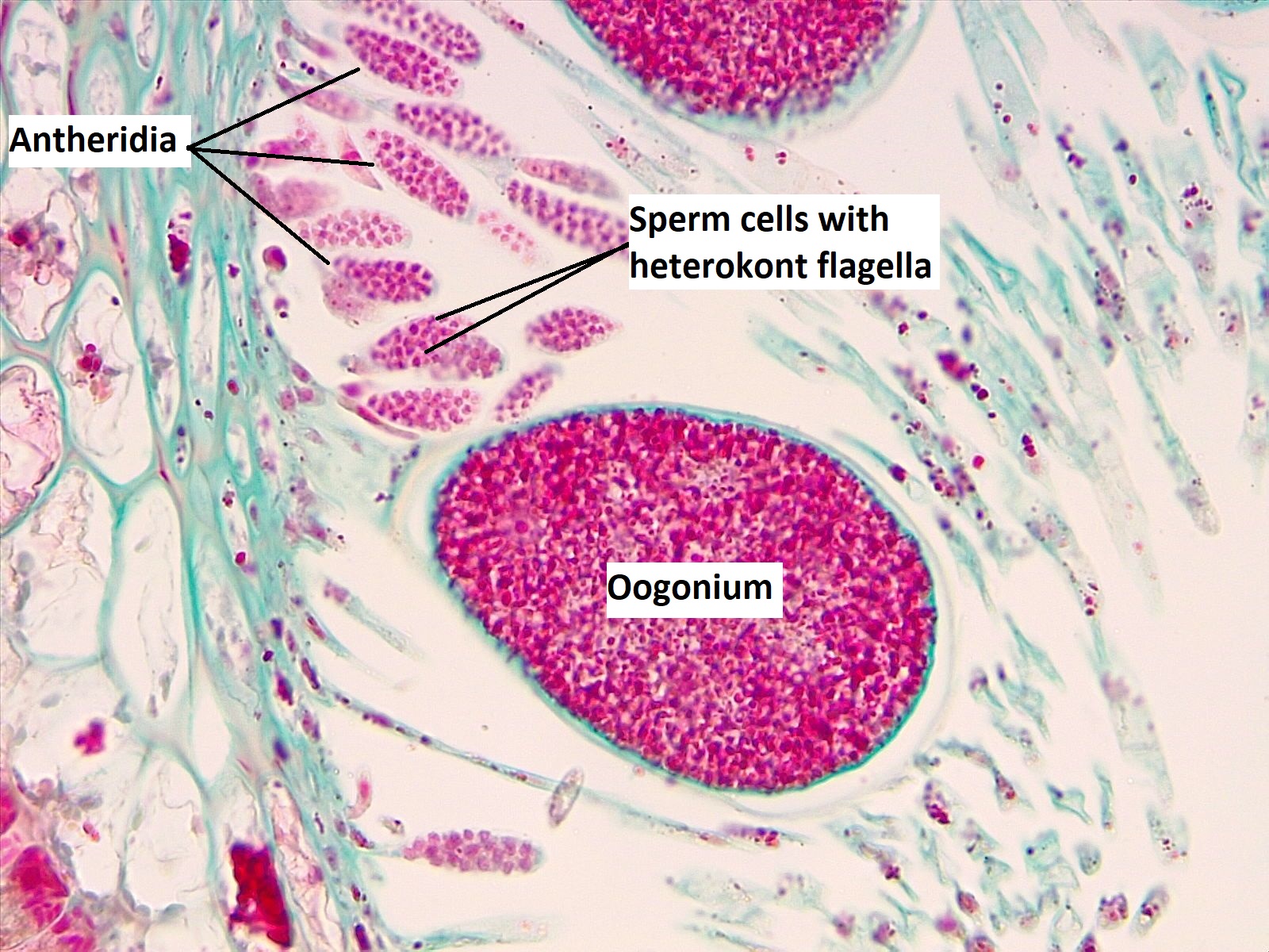 Fucus gametangia: a globose oogonium and thin, branching antheridia