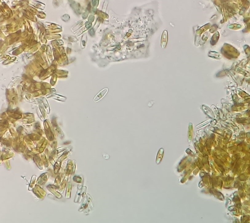 Clusters of diatoms seen through a microscope