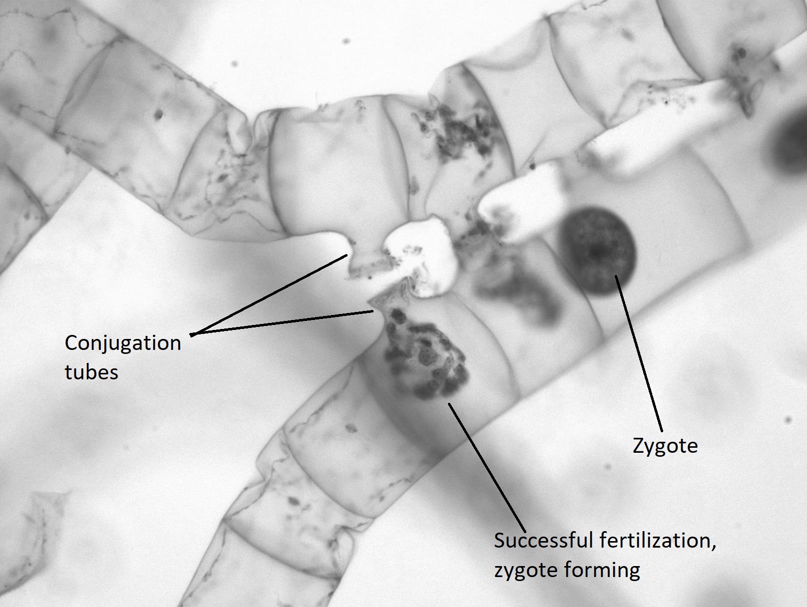Conjugación de espirogyra y formación de cigotos