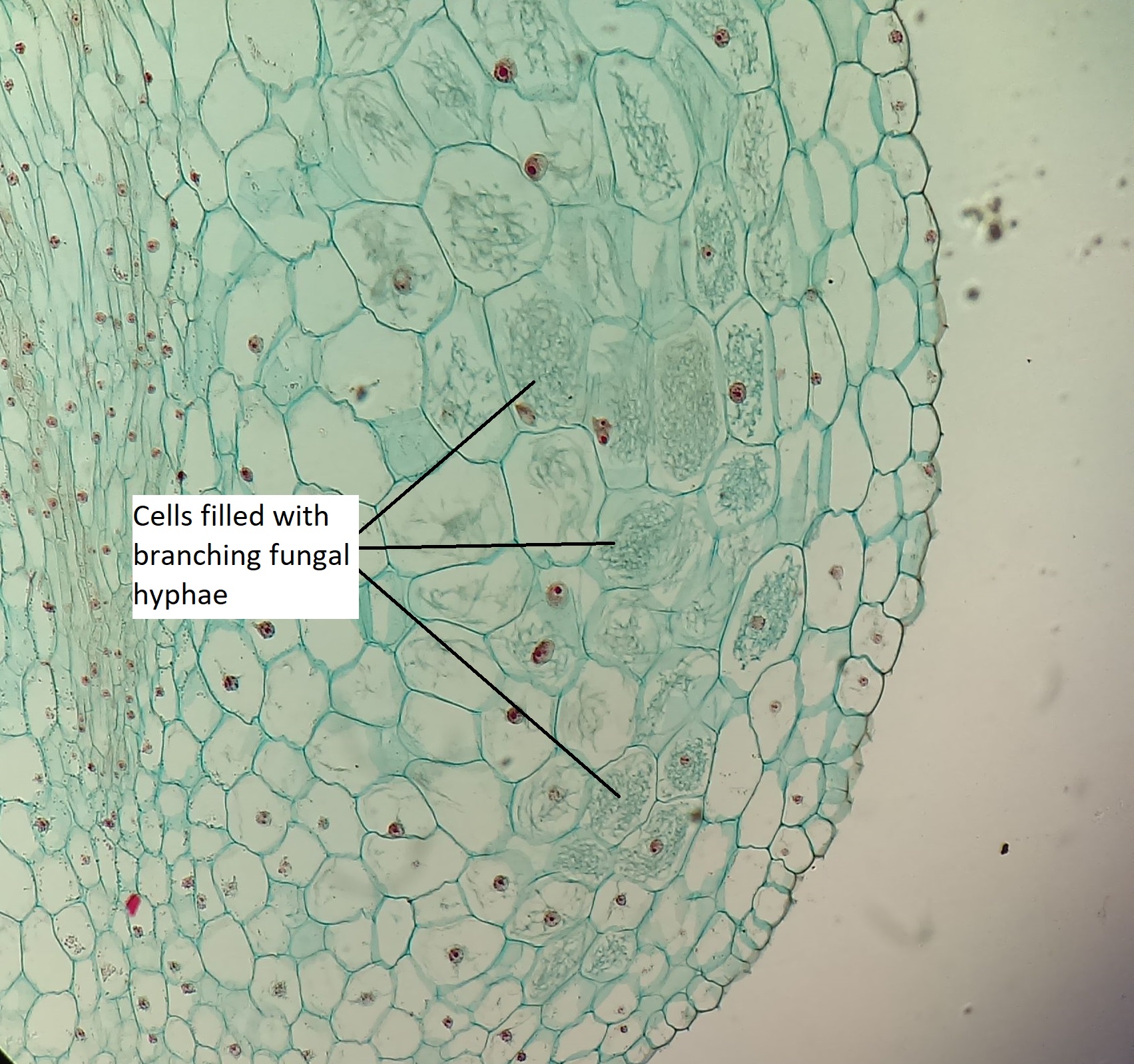 Una sección transversal de una raíz de planta que muestra estructuras de ramificación dentro de las células