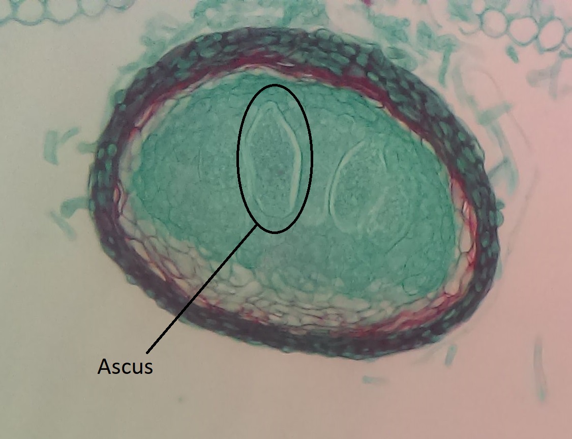 A section through a cleistothecium with an ascus circled