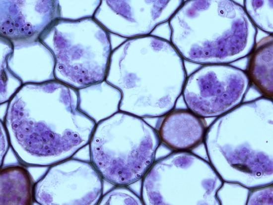 Ranunculus root starch granules in cortex cells