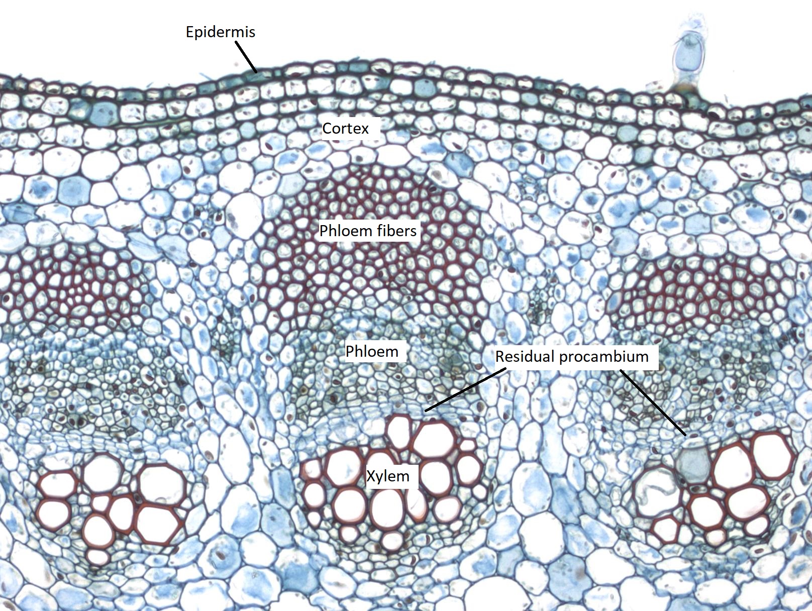 Helianthus young stem vascular bundles, cortex, and epidermis