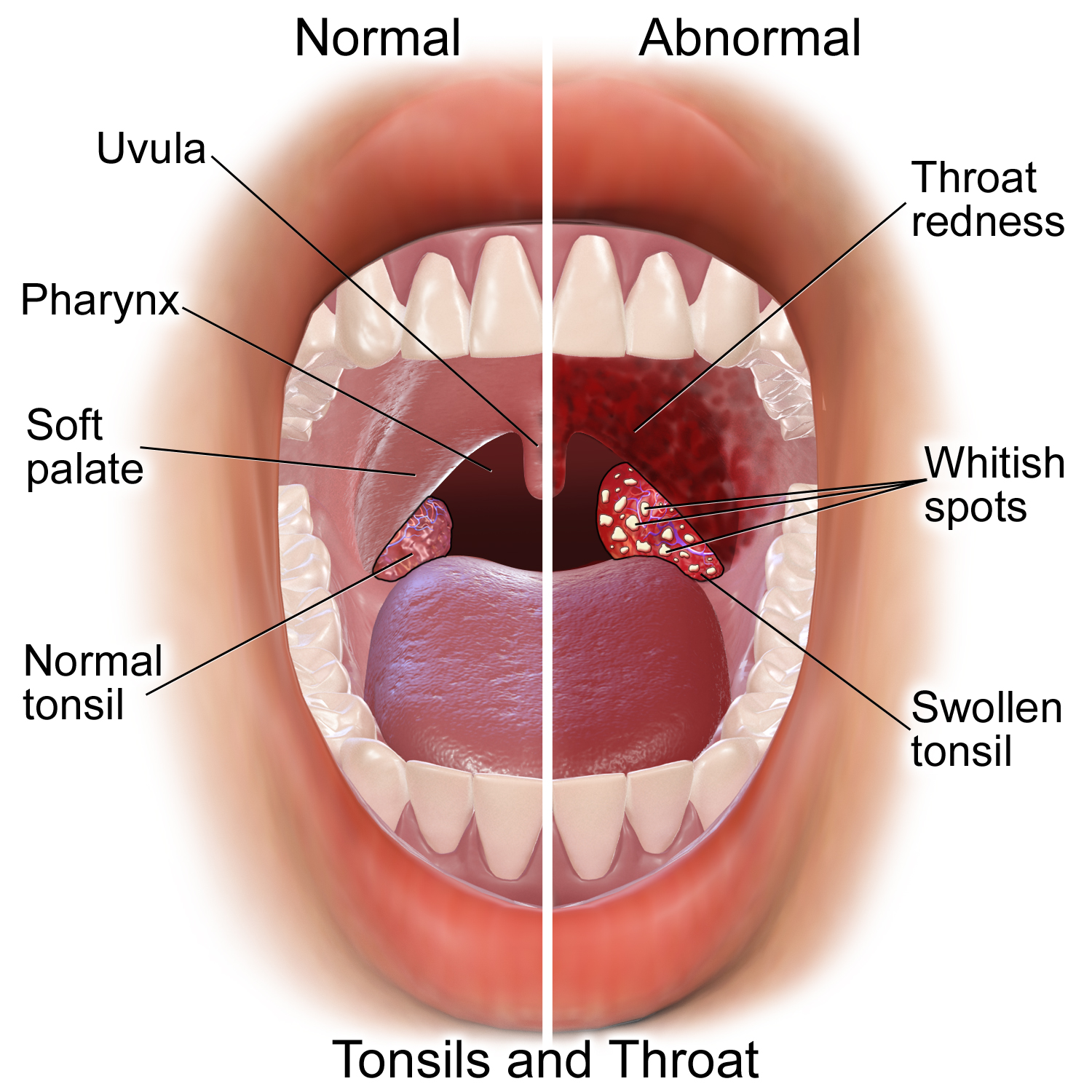 Anatomy of tonsils and throat