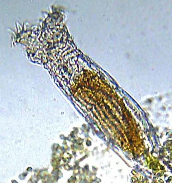 Un animal cilíndrico transparente bajo el microscopio
