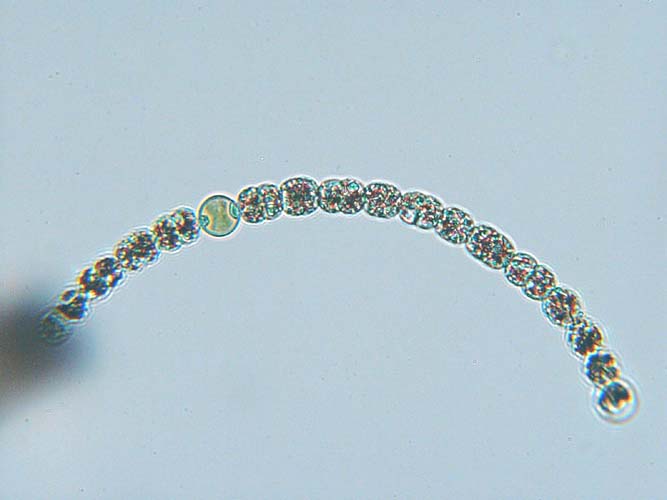 A chain of green, circular cells. Most are grainy, but one is lighter and transparent.