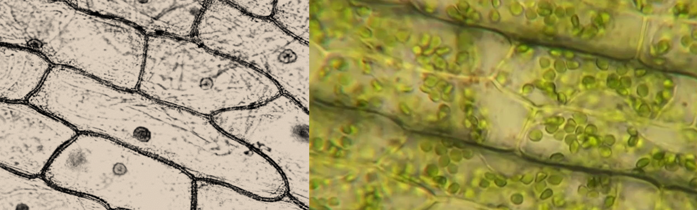 Plant Cell Types, onion cell showing nucleus and Eldoea cell showing chloroplasts