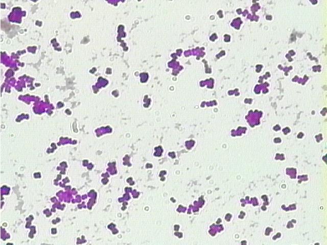 Cocci bacteria at 400 times magnification