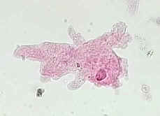 Microscope image of Amoeba proteus