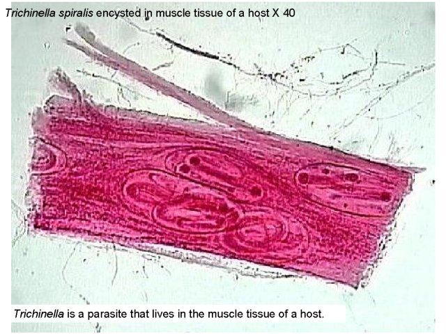 Figure 1. Trichinella spiralis encysted in muscle tissue of a host X 40