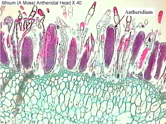 Figure 4. Mnium (a moss) antheridial head x40
