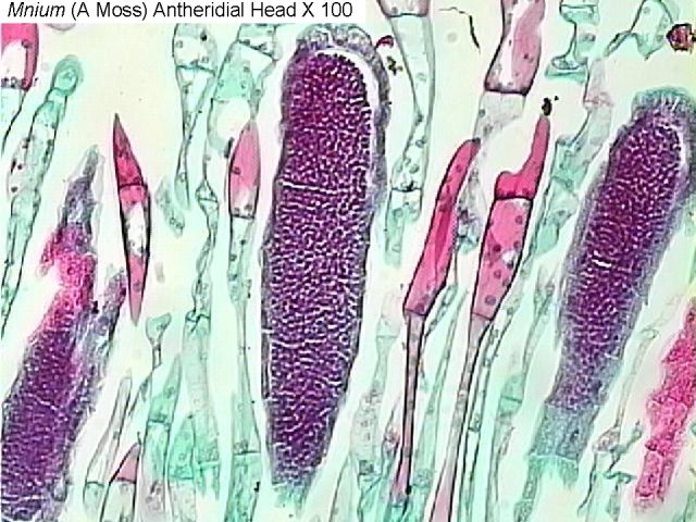 Figure 5. Mnium (a moss) antheridial head x100