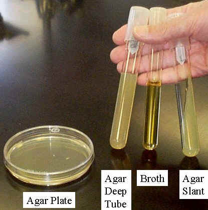 Photograph of the four common culture media: agar plate, agar deep tube, broth, and agar slant.