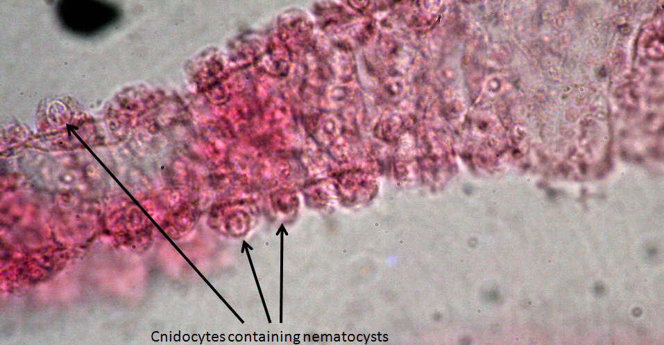 Figure 8. Portion of a Hydra tentacle showing cnidocytes