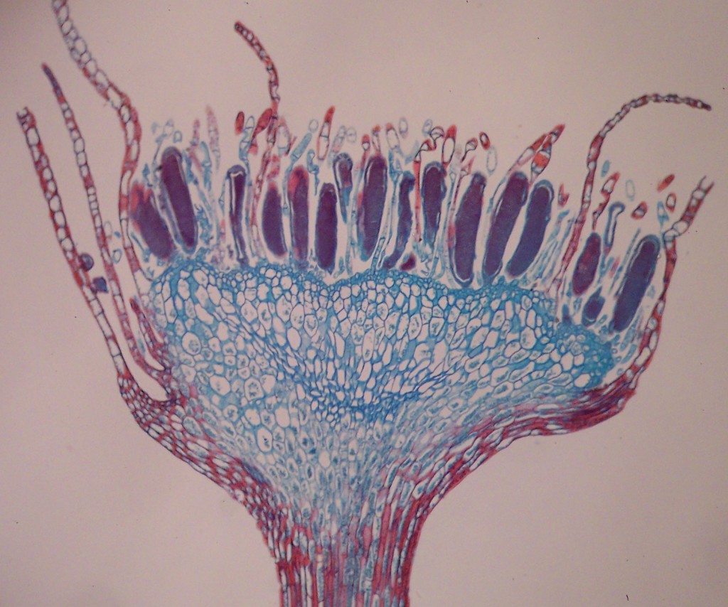 Figure 5. Mnium (a moss) antheridial head