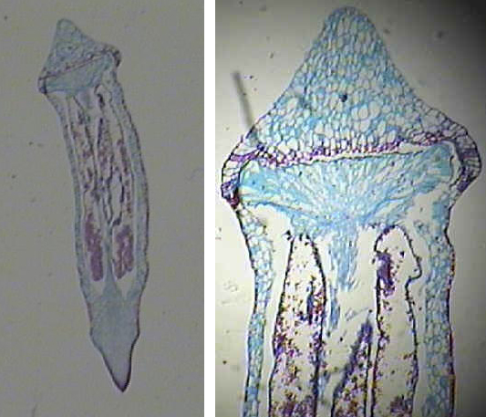 Figure 8. Moss capsule containing spores