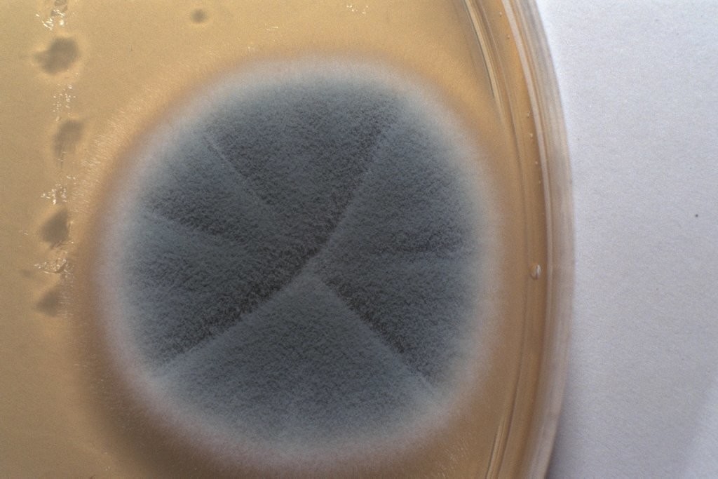 Figure 10. Penicillium growing on an agar plate
