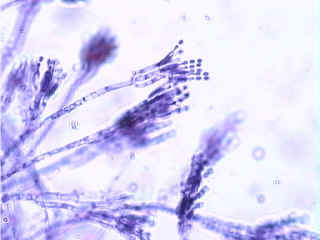 Figure 6. Penicillium Conidiophores and conidia X 400.
