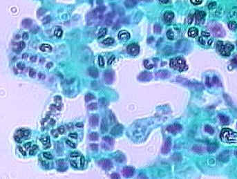 Figure 9. Schizosaccharomyces octosporus X 1000