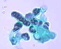 Figure 8. Schizosaccharomyces octosporus X 1000