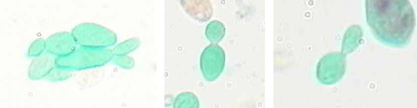 Figure 7. Yeast (Saccharomyces) budding X 1000.   