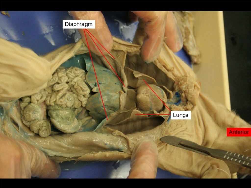 Diaphragm and lungs are labelled.