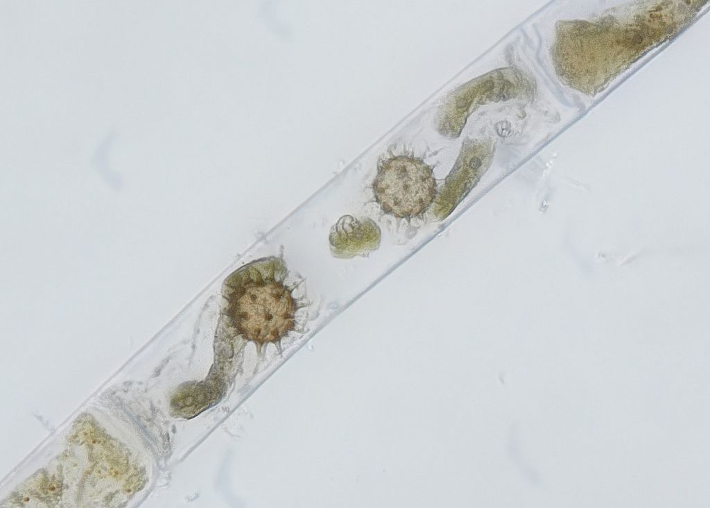 Micromyces zygogonii, un hongo quítrido, que vive dentro de las células de Spirogyra