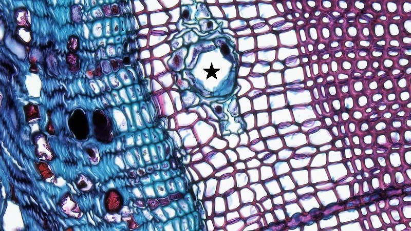 Sección transversal de madera de pino que muestra una abertura circular en las traqueidas rojas rodeadas por células de parénquima de paredes delgadas.