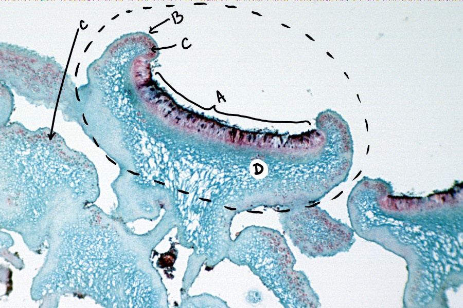 A light micrograph of a cross section through the apothecium of a lichen (labeled) 