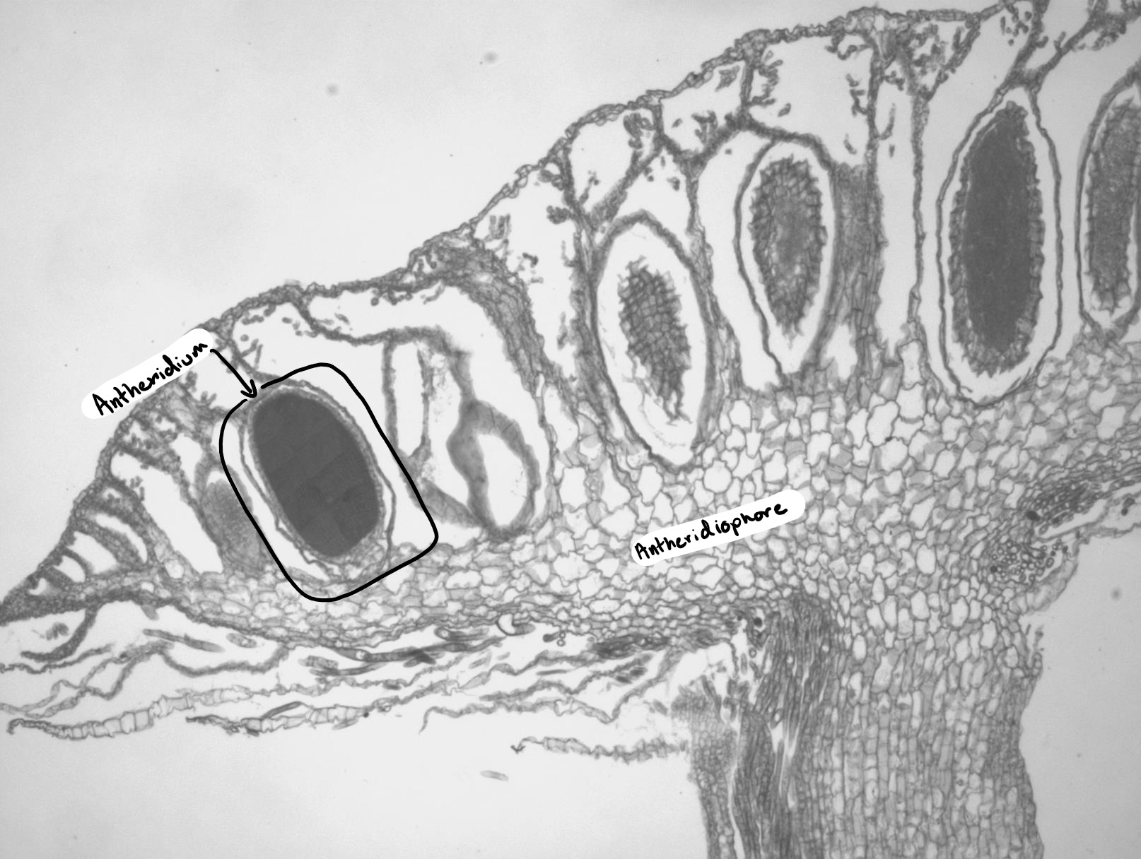 Marchantia antheridiophore long section
