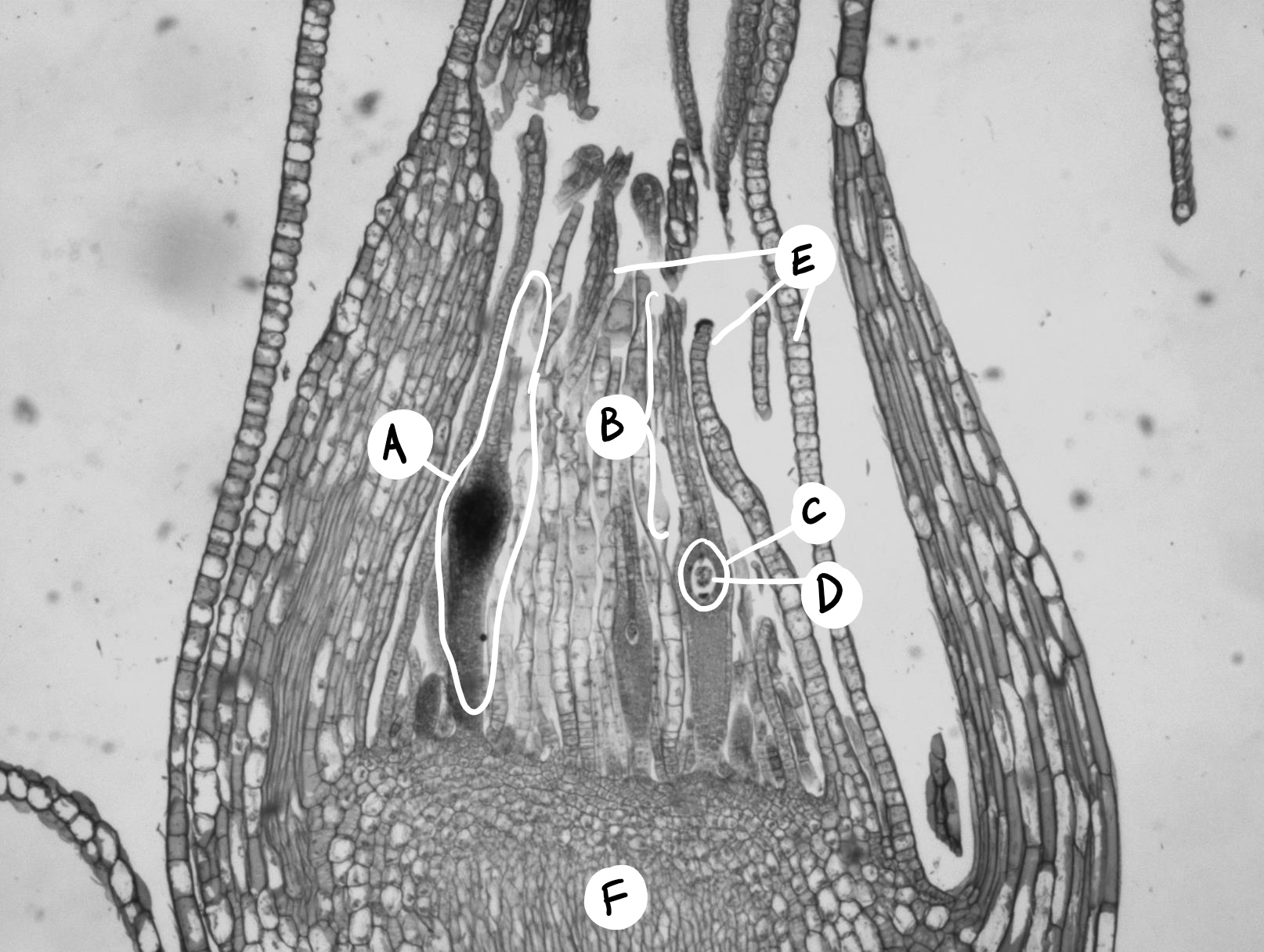 Long section through a Mnium female gametophyte