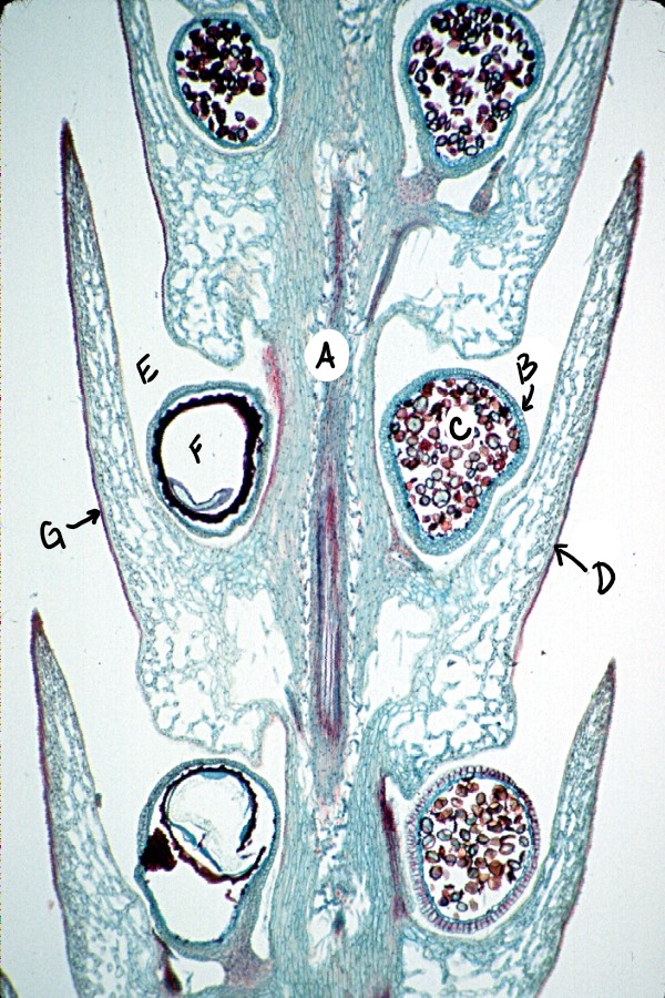Una sección larga a través de una Selaginella strobilus que muestra microsporas y megasporas