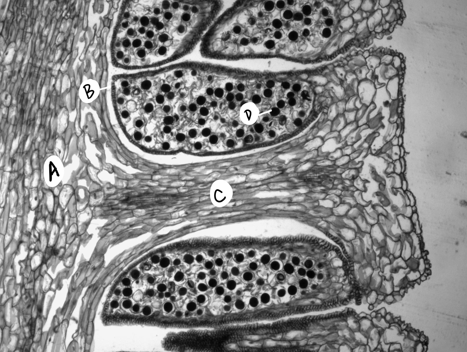 A long section through a single sporangiophore. All of the spores in the sporangia are about the same size